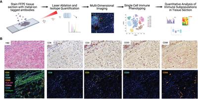 Adaptation of Imaging Mass Cytometry to Explore the Single Cell Alloimmune Landscape of Liver Transplant Rejection